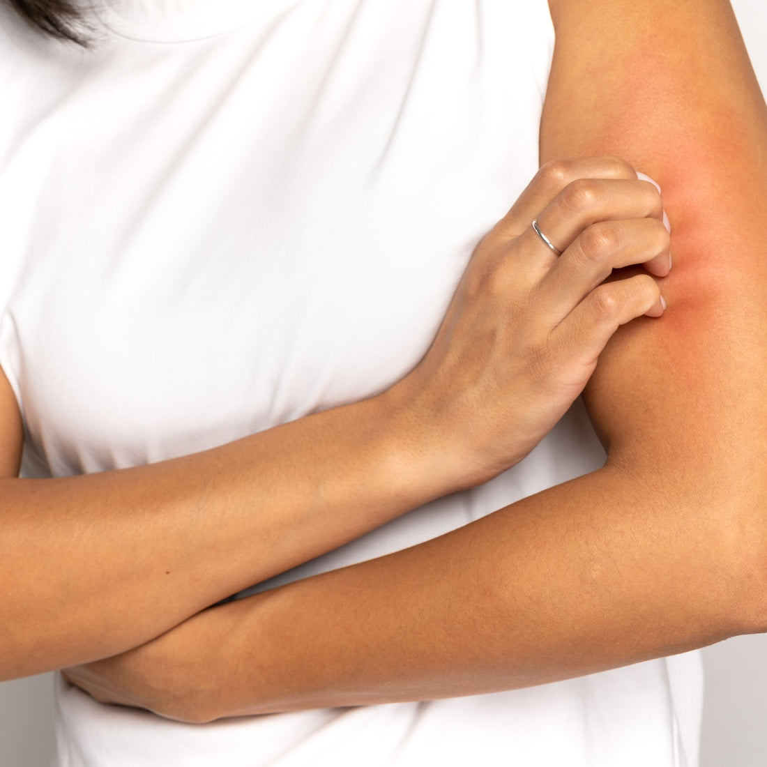 Skin Irritation Caused by Your Clothing