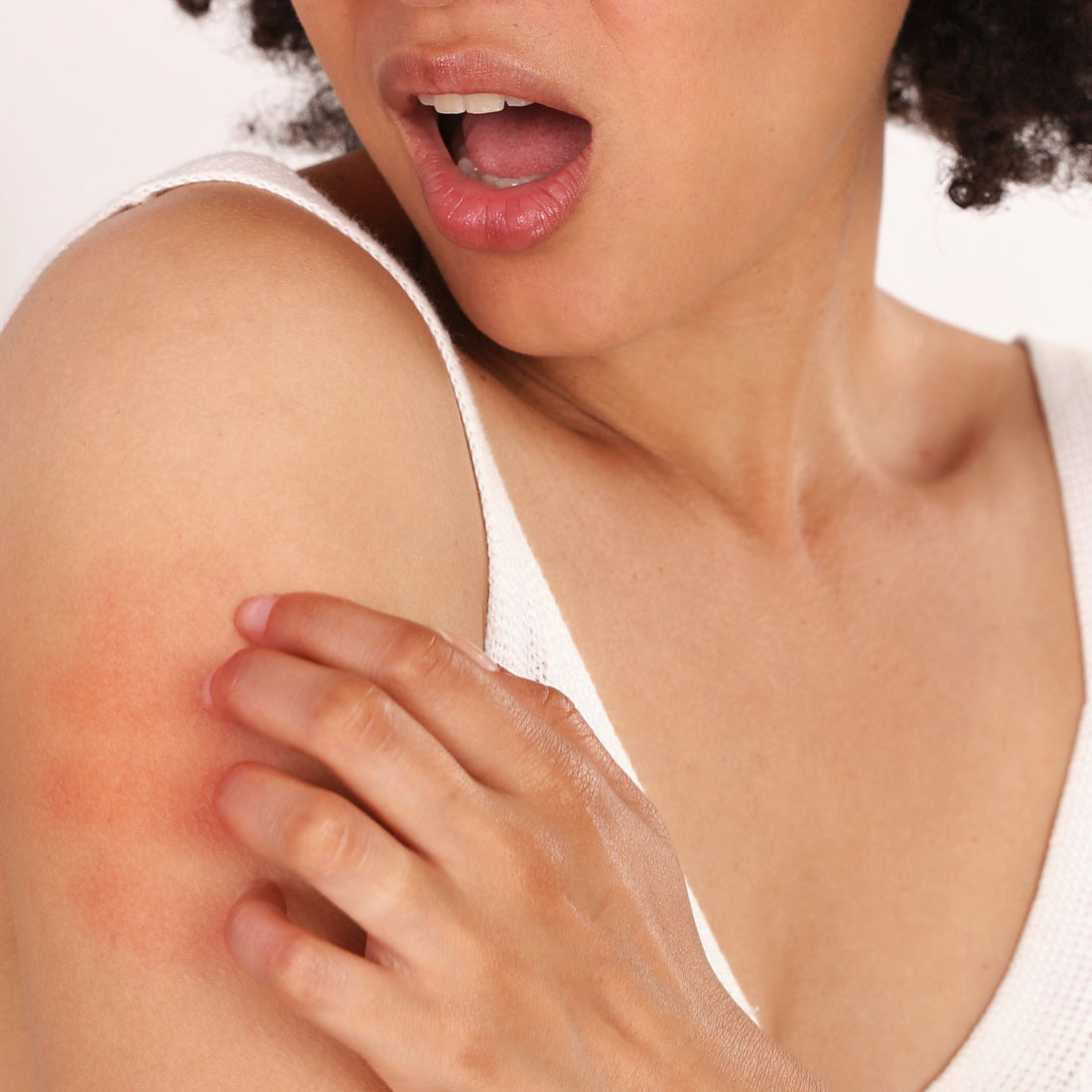 Dry skin solutions with natural skin care